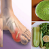 How To Remove Dangerous Uric Acid Crystals From Your Body To Prevent Gout And Joint Pain