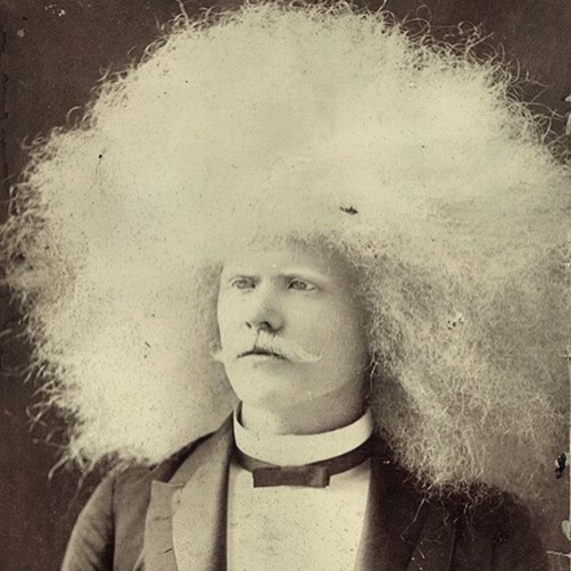 Portraits of Unzie, an Albino Aborigine Man With an Abundance of White