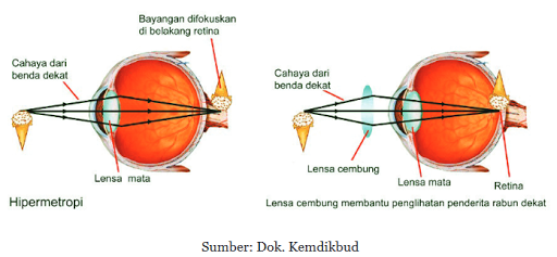 Wawan Listyawan Materi Cahaya Dan Optik Part 8 Rabun Dekat Dan Rabun Jauh