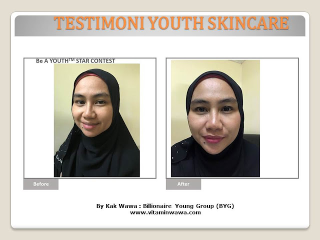 34 Testimoni Youth Skincare Shaklee Terbaru, Youth skincare shaklee, testimoni youth skincare shaklee, Youth Skincare Shaklee : Harga dan Review Pengguna Youth Shaklee, testimoni youth skincare shaklee, testimoni youth skincare shaklee 34 Testimoni Youth Skincare Shaklee Terbaru, Youth skincare shaklee, testimoni youth skincare shaklee, Youth Skincare Shaklee : Harga dan Review Pengguna Youth Shaklee, testimoni youth skincare shaklee, testimoni youth skincare shaklee
