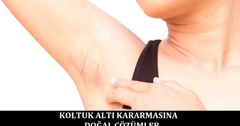 Koltuk Alti Neden Kararir Koltuk Alti Kararmasina Etkili Cozumler Guzellik Haberleri