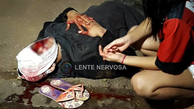 Garupa de moto sofre graves ferimentos após piloto invadir preferencial e ser atingido por automóvel