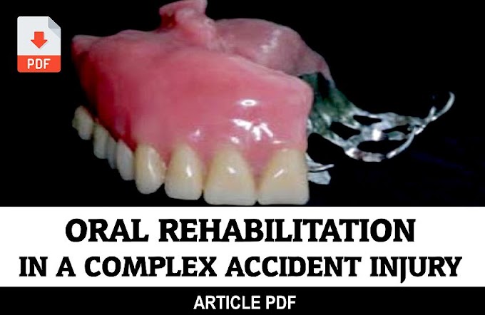 PDF: A Simple Procedure for Oral Rehabilitation in a Complex Accident Injury: A Case Report