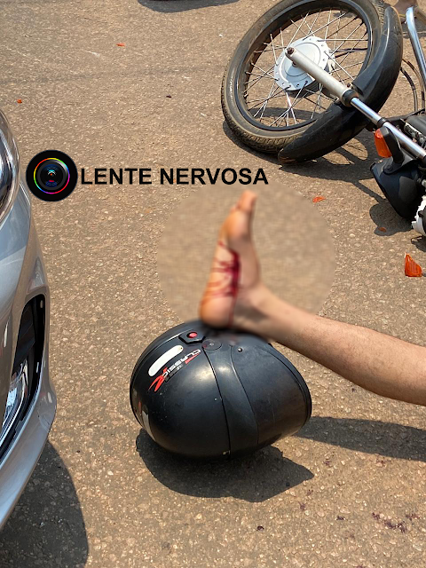 Motociclista sofre grave ferimento em acidente na Avenida Jatuarana 11 Motociclista sofre grave ferimento em acidente na Avenida Jatuarana