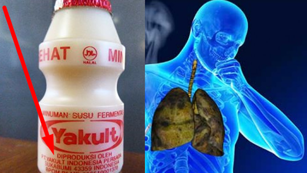 MENGEJUTKAN !!! Apakah Anda Sering Minum YAKULT Ini? Kalo Iya Berarti