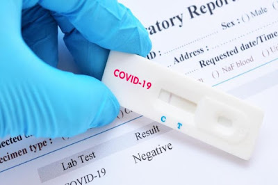 Rapid Test Bukan Mewakili Hasil Diagnosa Covid-19, Agar Tidak Gagal Paham