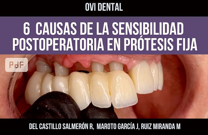 PDF: 6 causas de la Sensibilidad Postoperatoria tras el cementado en Prótesis Fija 