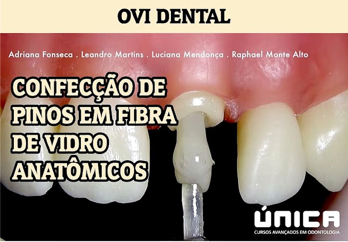 PINOS DENTÁRIOS: Confecção de pinos em fibra de vidro anatômicos