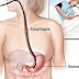 THIS FOOD IS THE BEST PREVENTION FOR STOMACH CANCER AND WE ALL HAVE IT IN OUT HOMES!