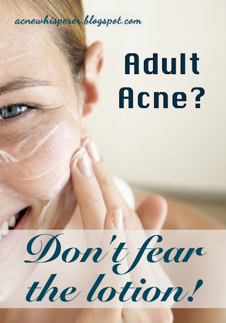 Adult Acne don't fear the lotion