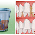 RINSE YOUR MOUTH FOR 30 SECONDS WITH THIS RECIPE TO REMOVE TARTAR AND BACTERIAL PLAQUE FROM YOUR TEETH!