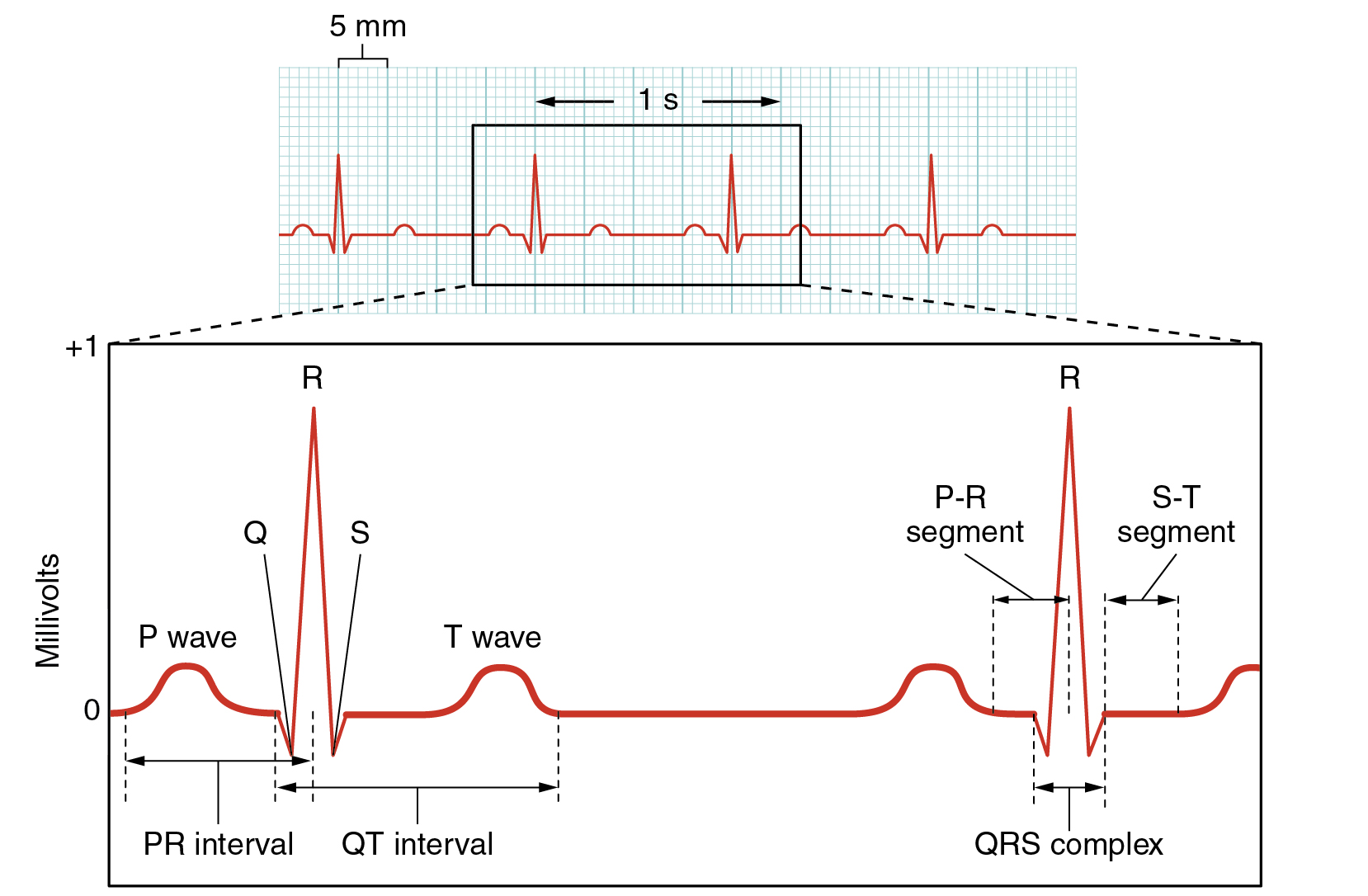 HOW TO READ AN ECG