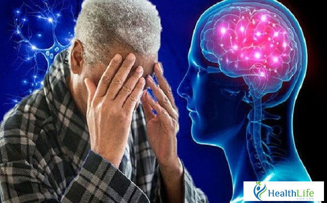 10 common causes of memory Impairment 10 common causes of memory Impairment