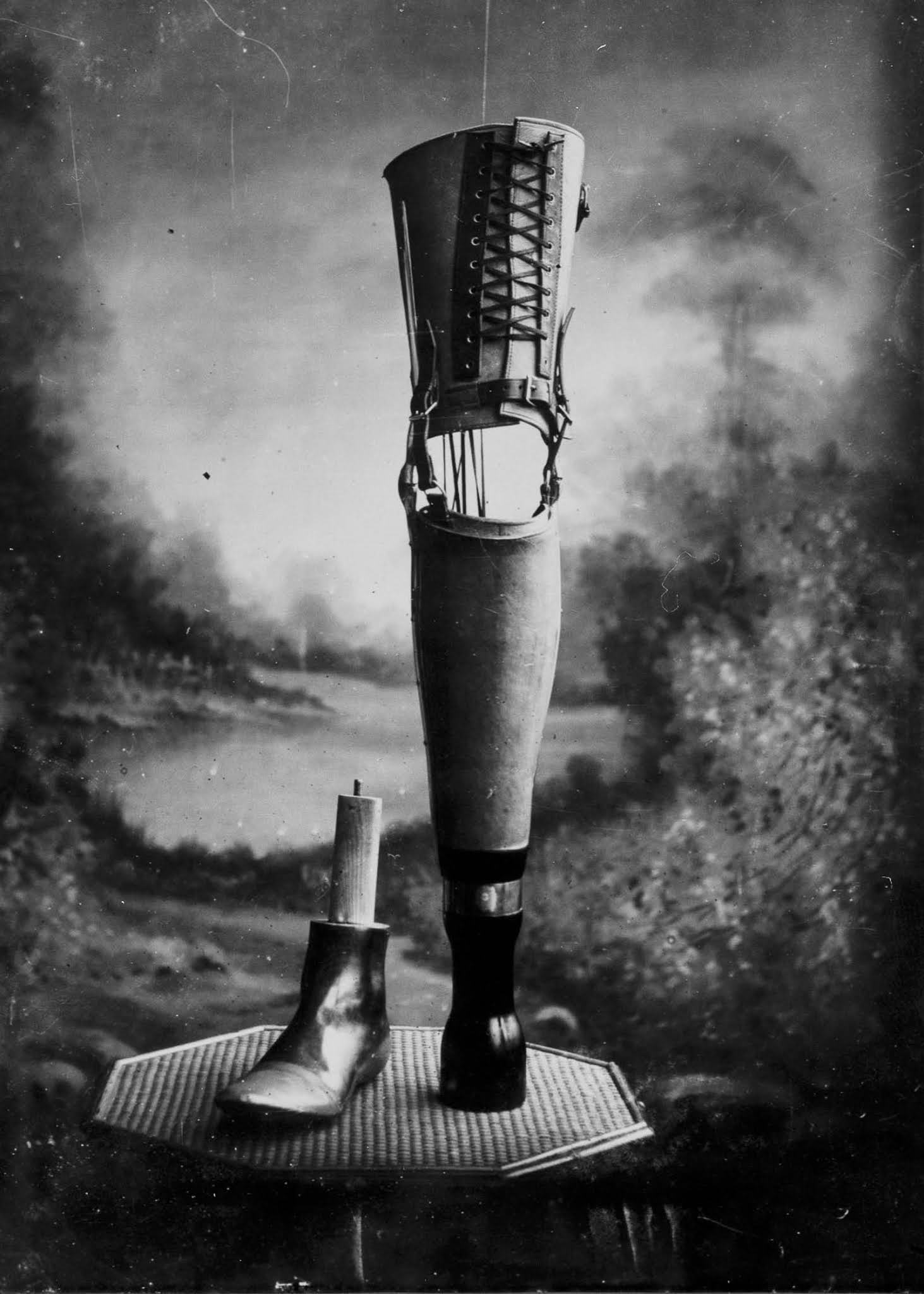 The extraordinary early prostheses made by James Gillingham  1900 - 57