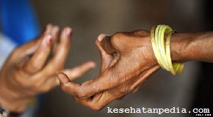 Penyebab dan Gejala Penyakit Kusta - kesehatanpedia