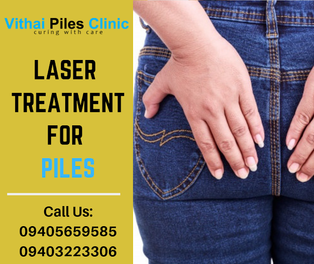 treatment of pile, Laser treatment, laser treatment for piles, laser treatment for fissures, laser treatment for fistulas in Pune, Vithai Piles Clinic