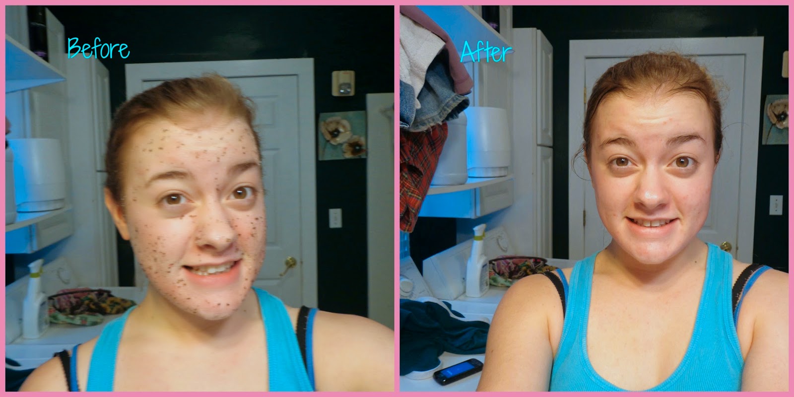 Grace's Musings D.I.Y Skin Clearing Facial Scrub