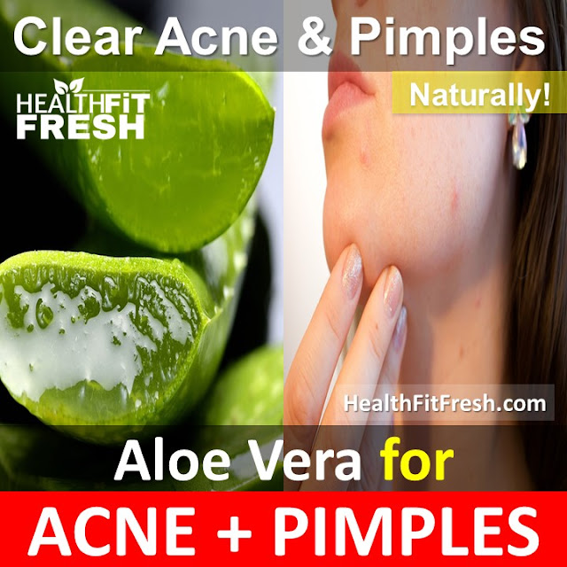How To Use Aloe Vera To Clear Acne Overnight Fast Health Fit Fresh