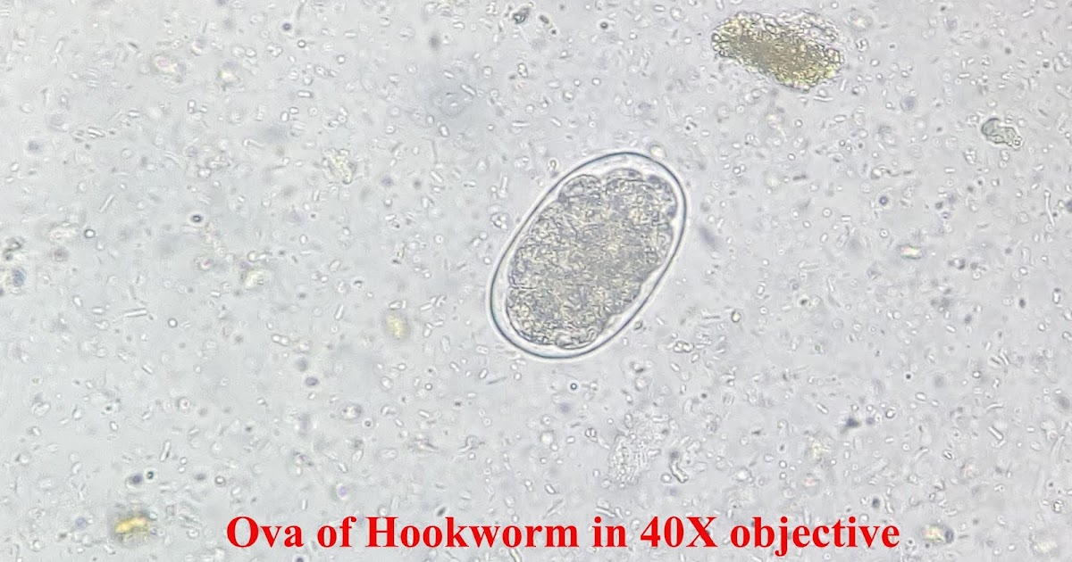 MICROBIOLOGY BLOG FOR STUDENTS (MBLOGSTU) OVA OF HOOKWORM