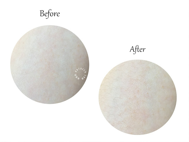 before after pemakaian azalea