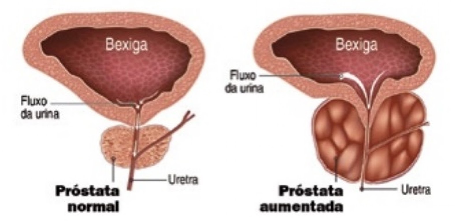 centro cura urologia prostata centro cura urologia prostata