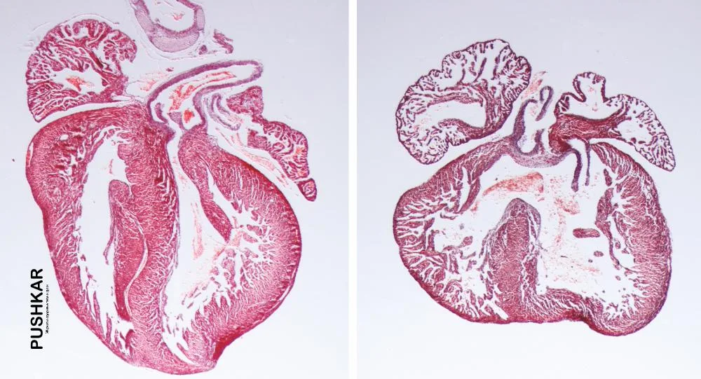 ДОБАВКИ ВИТАМИНА D СВЯЗАНЫ С УЛУЧШЕНИЕМ ФУНКЦИИ СЕРДЦА У ПАЦИЕНТОВ С СЕРДЕЧНОЙ НЕДОСТАТОЧНОСТЬЮ.