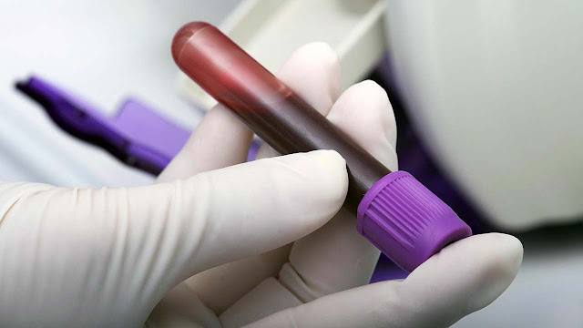 Em um ano, casos de Aids diminuem 60% na Bahia, aponta Sesab