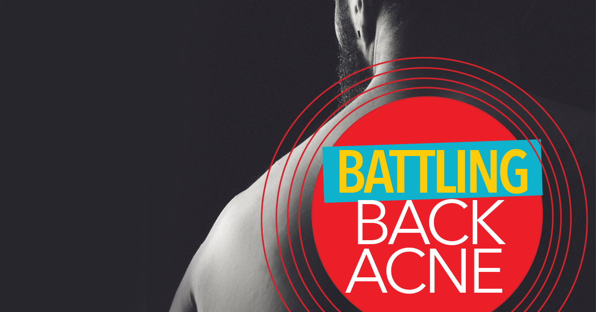 BACK ACNE HOW TO GET RID OF IT Jet Club