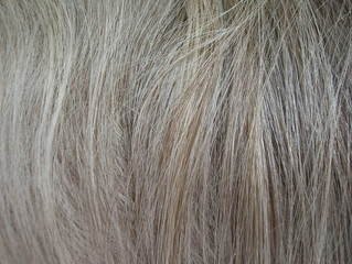 Premature Greying of hair- Cause and Natural treatment (home remedies)