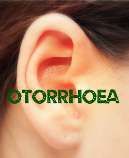 Otorrhoea : कान का बहना