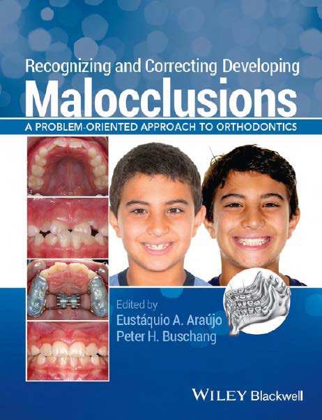 Recognizing and Correcting Developing Malocclusions A problem-oriented approach to orthodontics