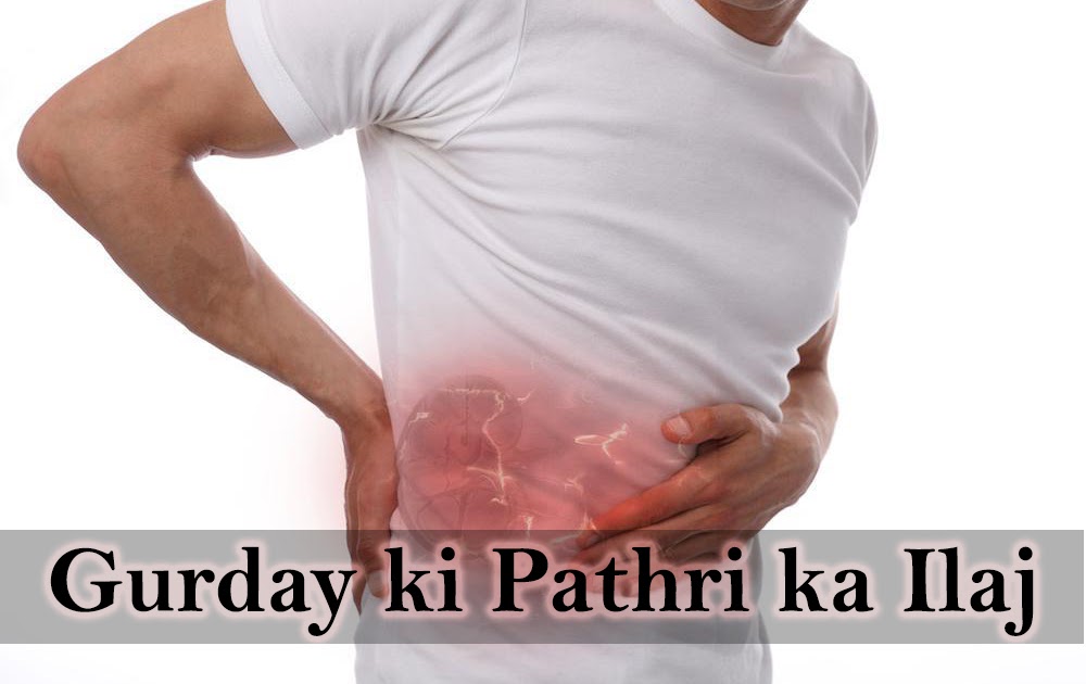 3 Best Herbal Medicines for Kidney Pain
