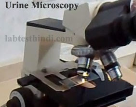 Urine microscopy
