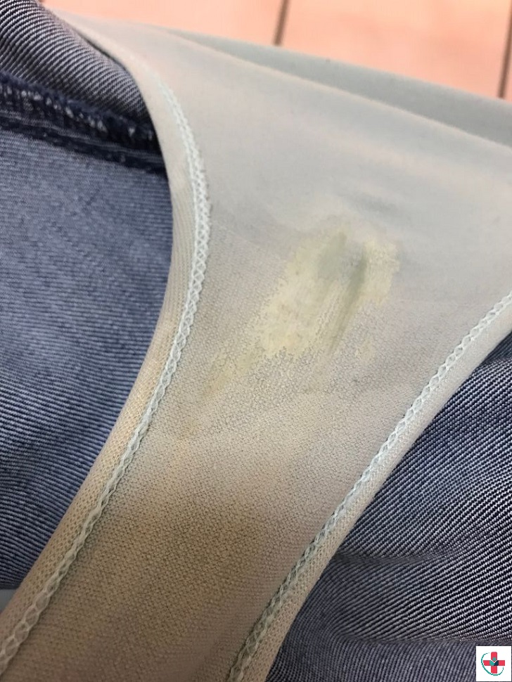 Vaginal Discharge Whats This On My Underwear Find Out 