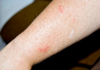 What is Raisin Water? Raisin Water Benefits and Side Effects