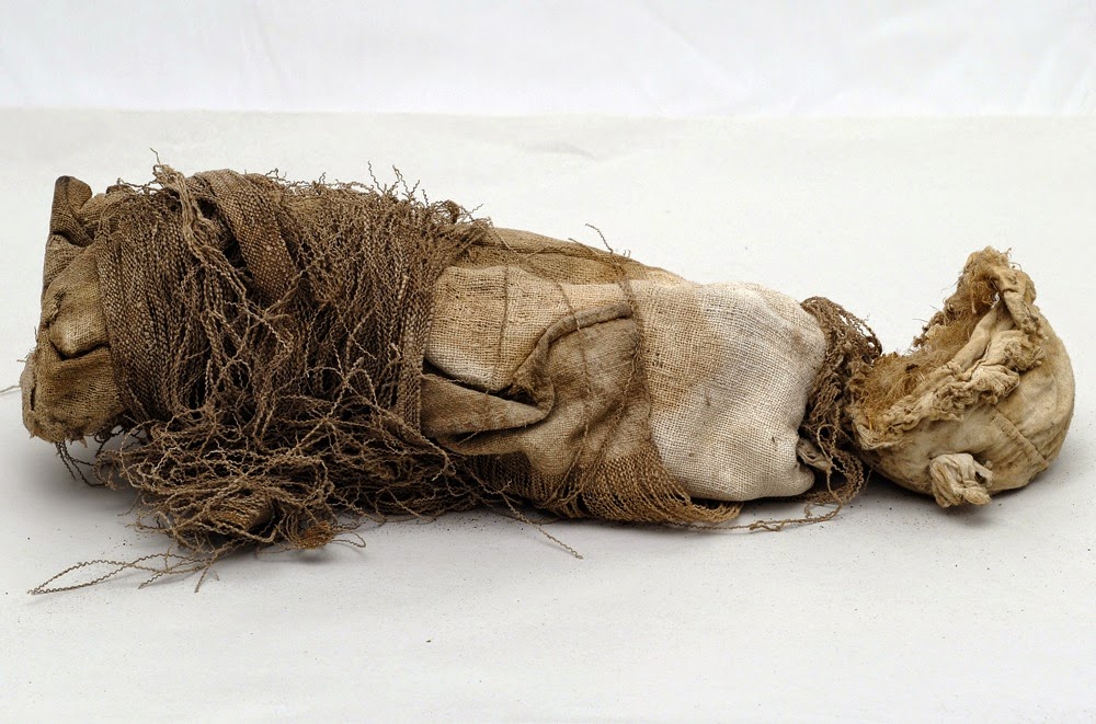 Mummified fetus reveals ancient surgical procedure