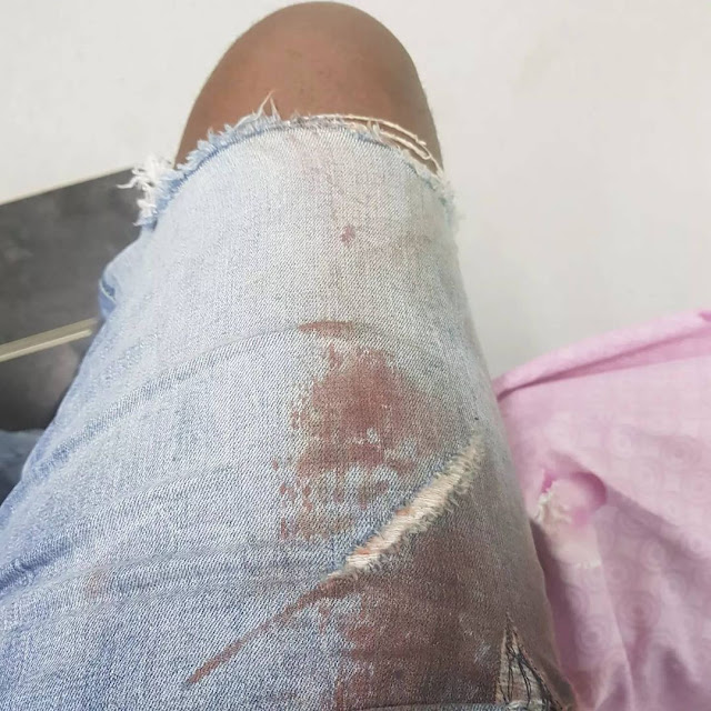 Nigerian Rapper, Mr Raw survives ghastly motor accident (photos/video)