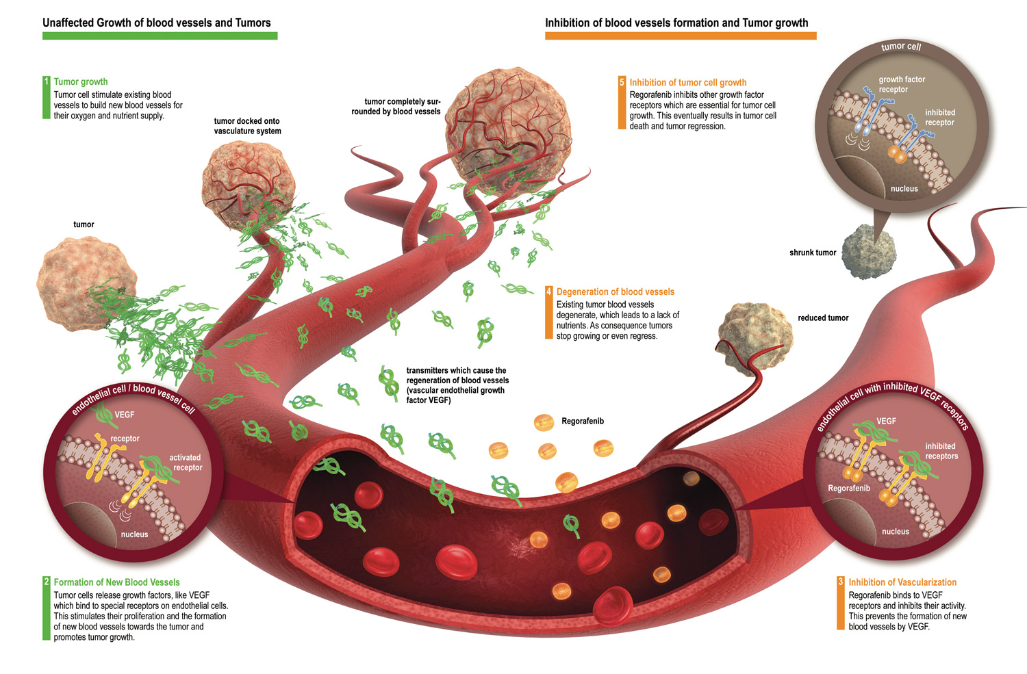 Gastrointestinal Stromal Tumor Gastrointestinal Stromal Cancer
