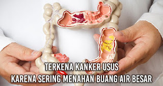 Terkena Kanker Usus karena sering menahan buang air besar