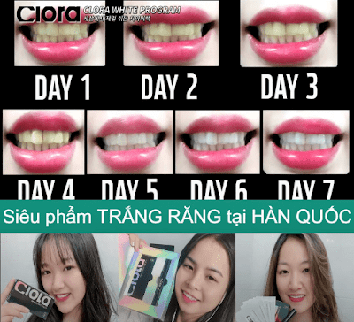 [Image: but-tay-trang-rang-clora-den-tu-thuong-h...n-quoc.png]