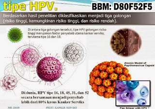 Obat Kutil Kelamin Obat Kutil Kelamin