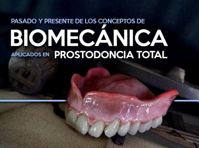 Biomecánica en PROSTODONCIA TOTAL - Dr. y TPD. Jorge Montes de Oca y el Dr. Enrique Armas