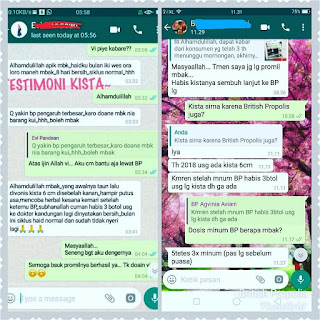 Testimoni British propolis mengobati kista ukuran mengecil dan hancur 1