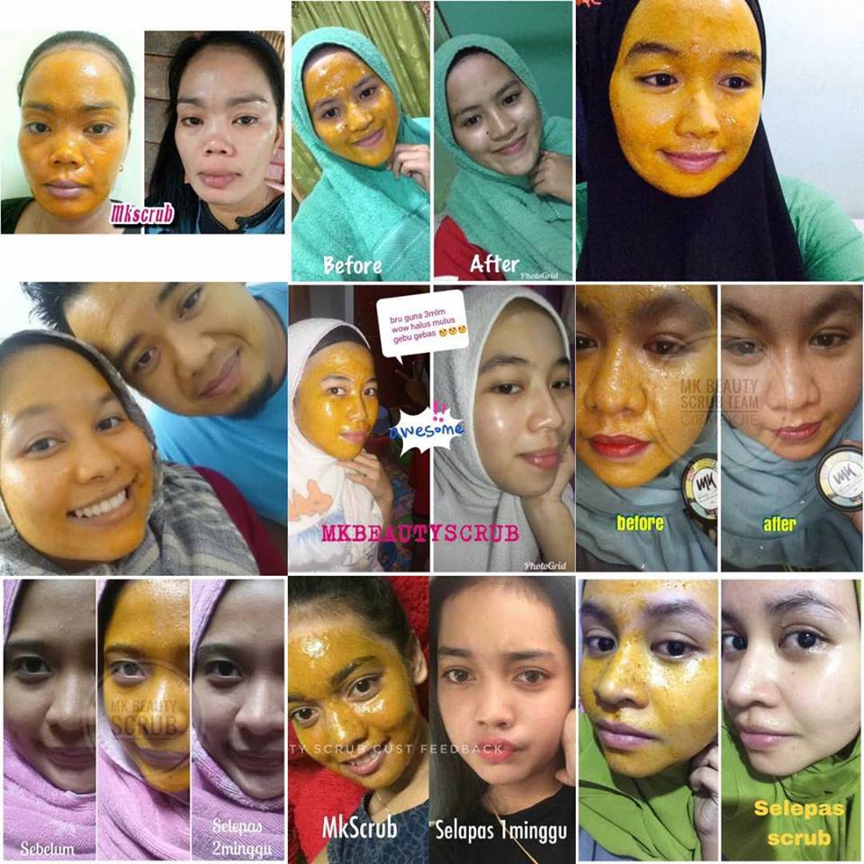 MK BEAUTY SCRUB ( SCRUB KUNYIT MADU HOMEMADE) ISTIMEWA DAN TERBAIK