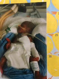 Amazing Story! Father Narrates How His Premature Child Drew Him Closer To God