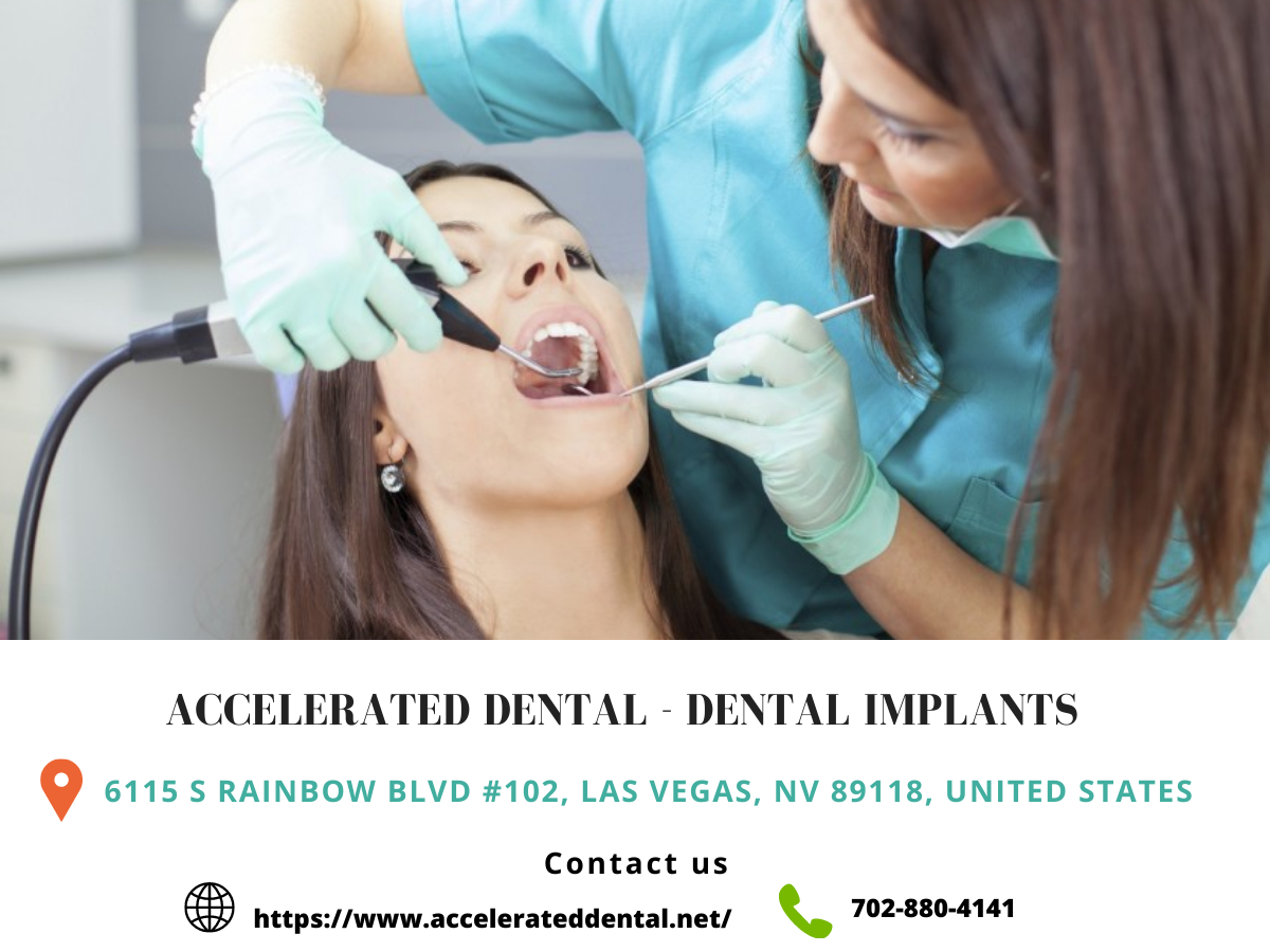 Accelerated Dental Top 5 Questions You Need To Ask Before Choosing