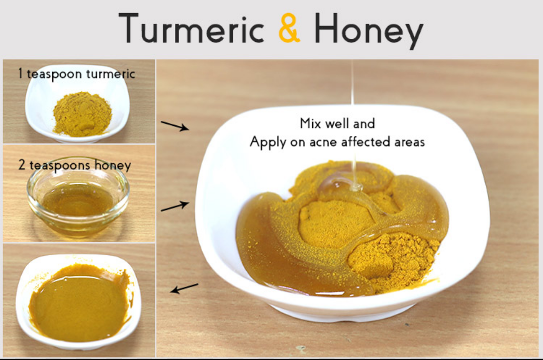 The obssessed fashion geek How To Remove Dry Skin From Your Legs & Feet