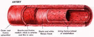 Natural Atherosclerosis Treatment