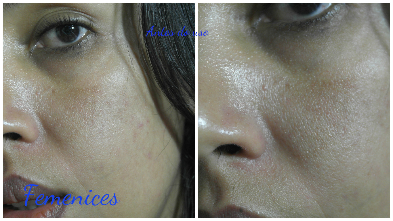 Resenha: Redemic R e Effaclar Anti-idade (La Roche- Posay)