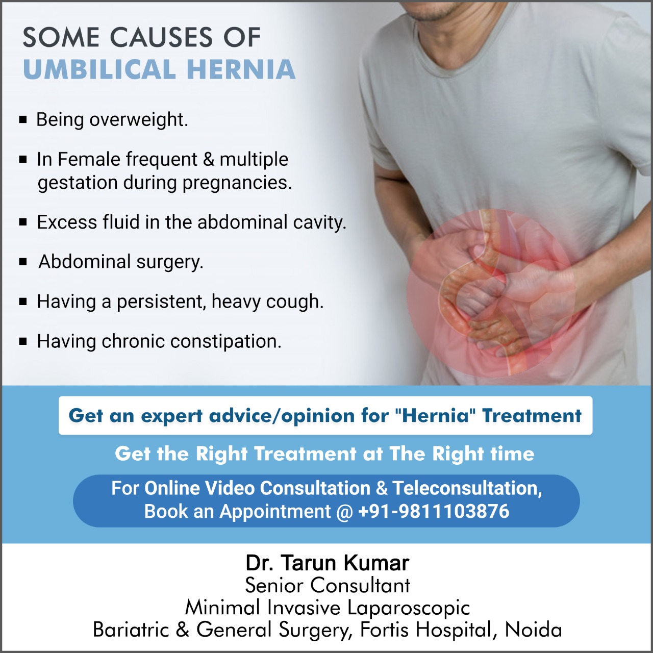 Dr Tarun Kumar Surgeon Some Causes Of Umbilical Hernia